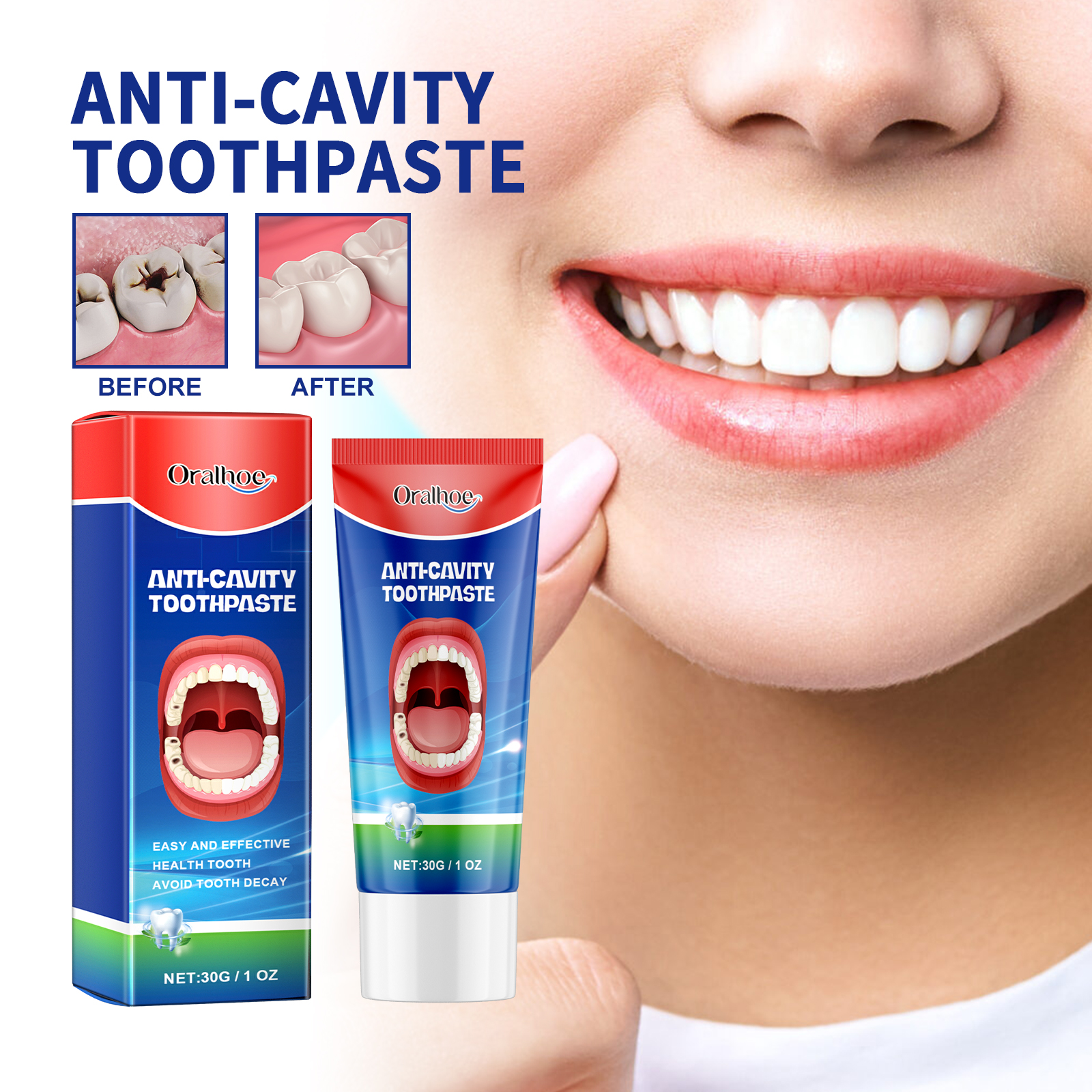Oralhoe Anti-Cavity Toothpaste Oral Cleansing Yellow Teeth Cavities Protects Gums and Strengthens Teeth Dental Care Freshens Breath-CLEJOY