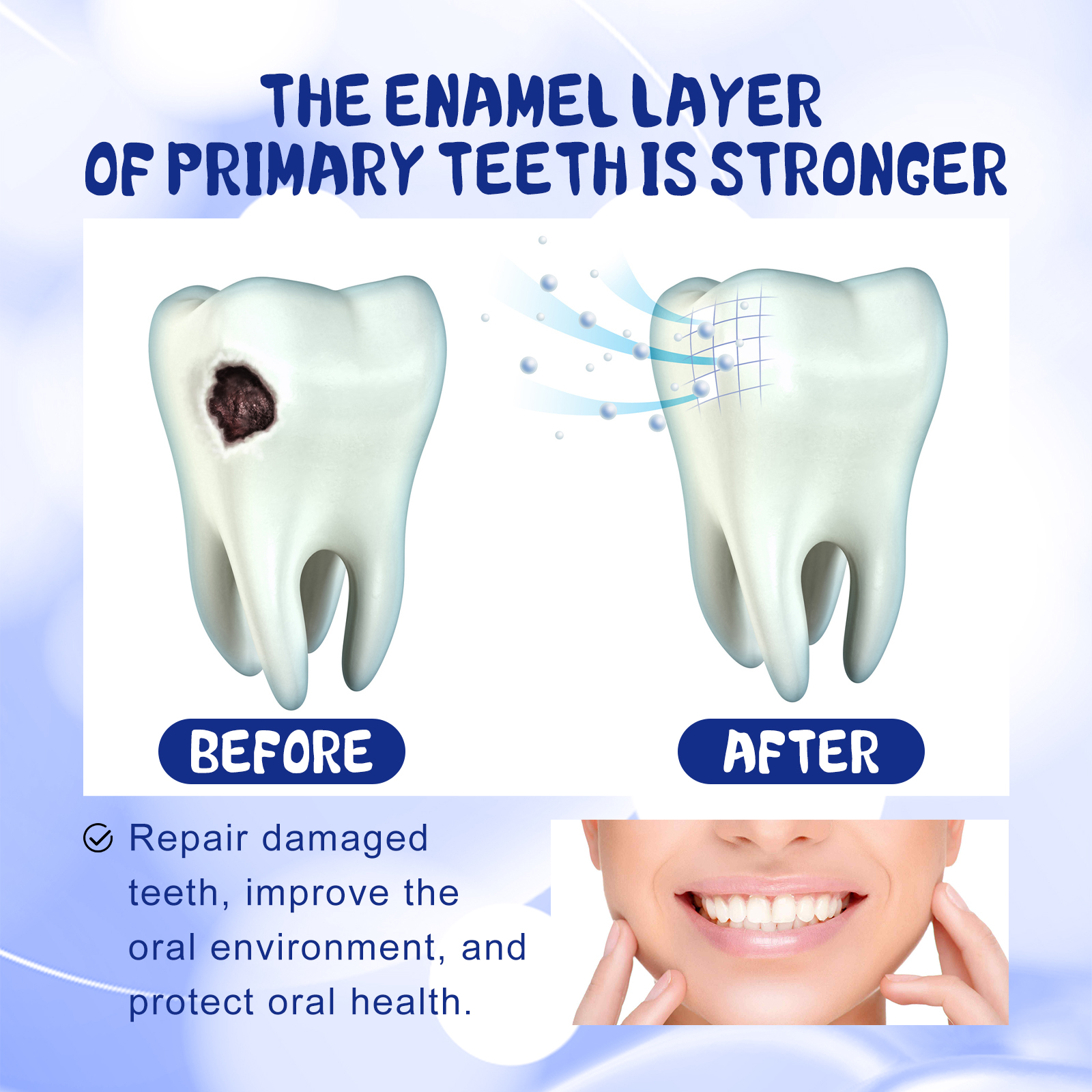 Oralhoe Anti-Cavity Toothpaste Oral Cleansing Yellow Teeth Cavities Protects Gums and Strengthens Teeth Dental Care Freshens Breath-CLEJOY