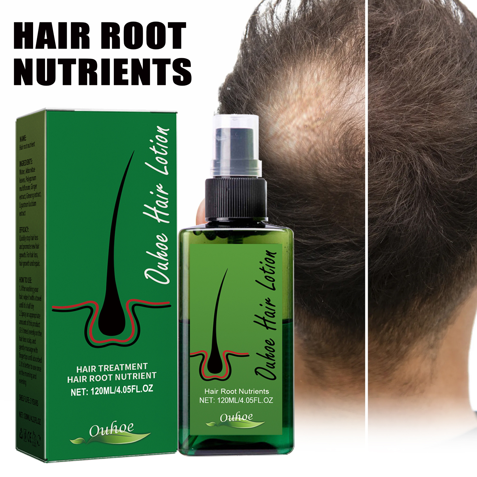 OUHOE Thickening Hair Spray Anti-hair loss, strong hair, repair hair roots, hair care spray