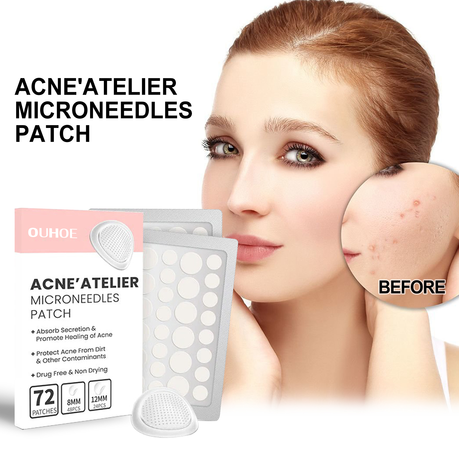 OUHOE Acne Patches Repair Acne and Facial Redness Cleans Pores and Moisturizes Skin