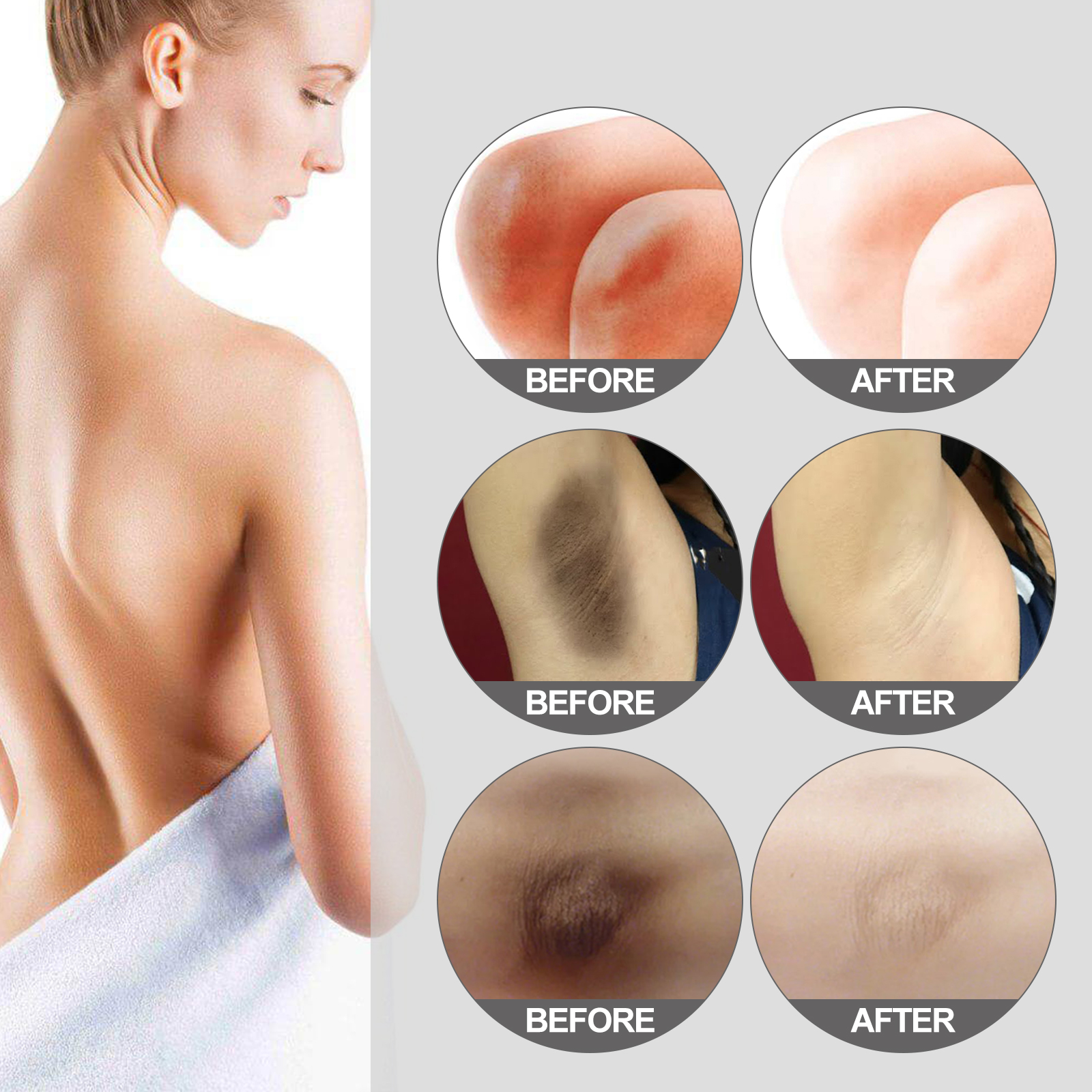 OUHOE Thigh Brightening Moisturizing Cream Moisturizing and brightening underarms, thighs, knees and joints moisturizing and brightening cream-CLEJOY