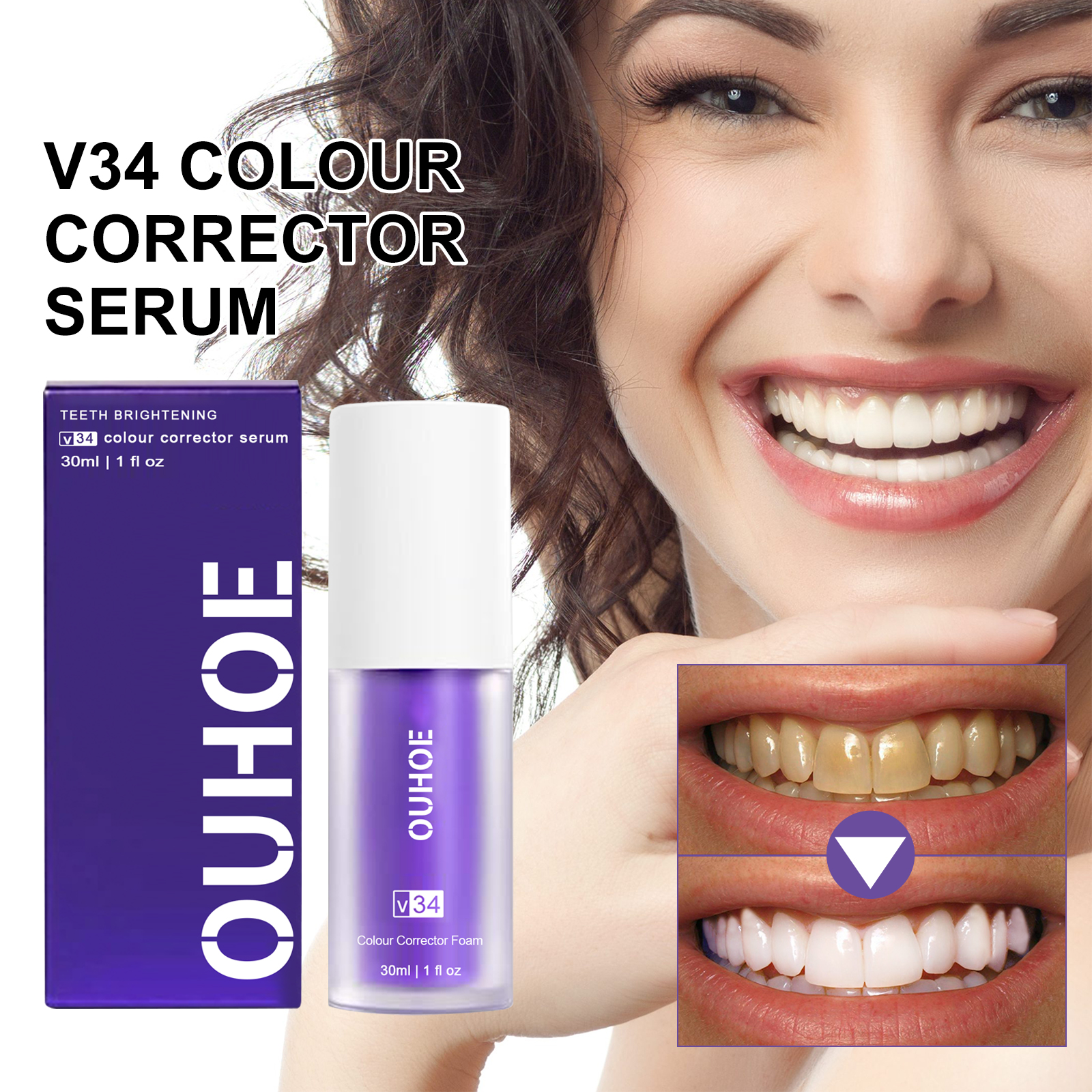 OUHOE Teeth Whitening: Professional glow and gum fix for a radiant smile finish.