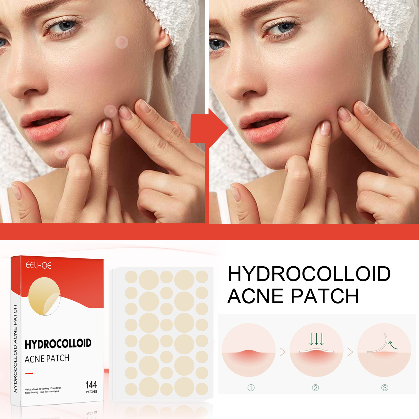 EELHOE hydrocolloid acne patch invisible makeup closed comedones waterproof breathable facial care