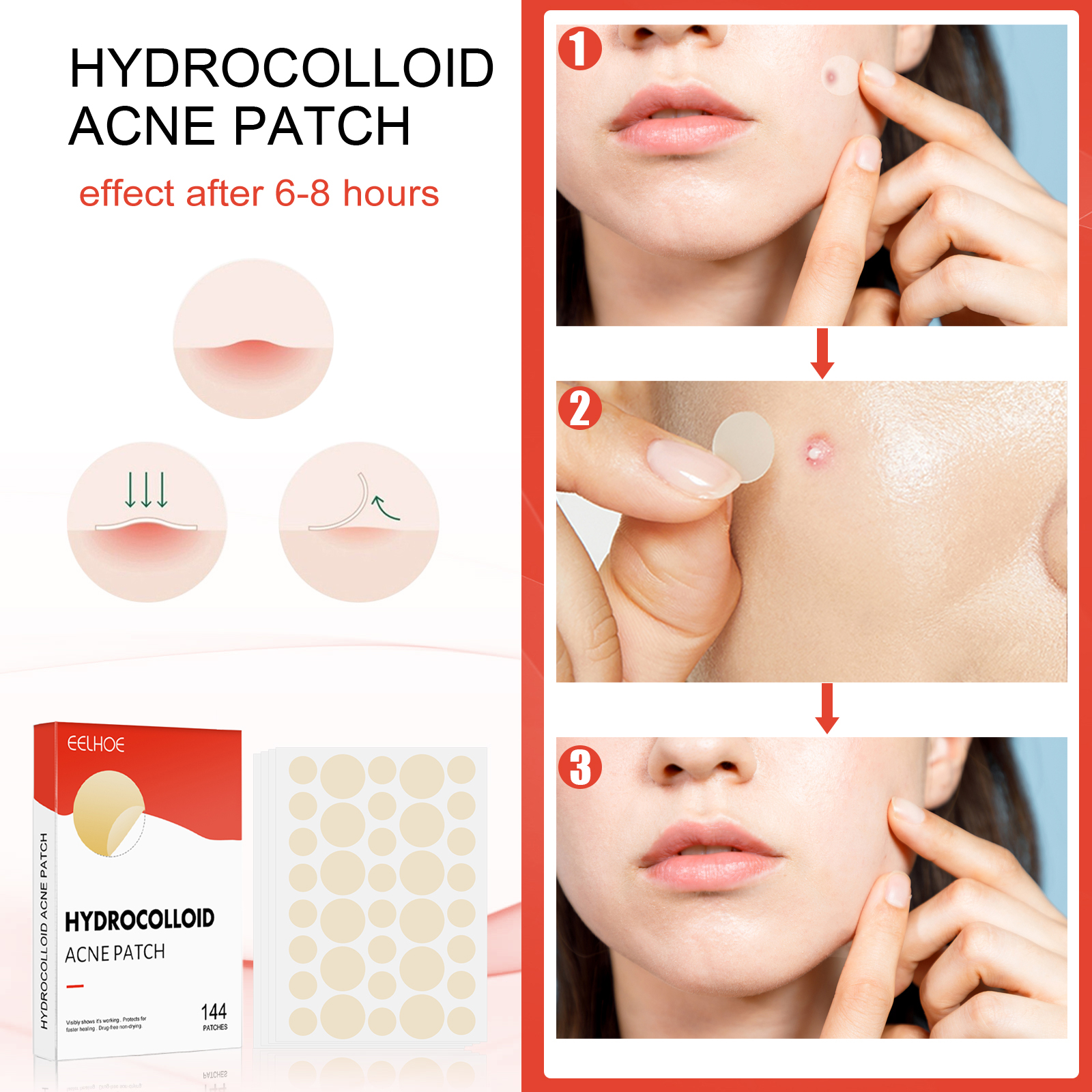 EELHOE hydrocolloid acne patch invisible makeup closed comedones waterproof breathable facial care