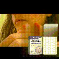 EELHOE spot patch lightens facial dark spots, chloasma, pigmentation, melanin, moisturizes and whitens skin spots-CLEJOY