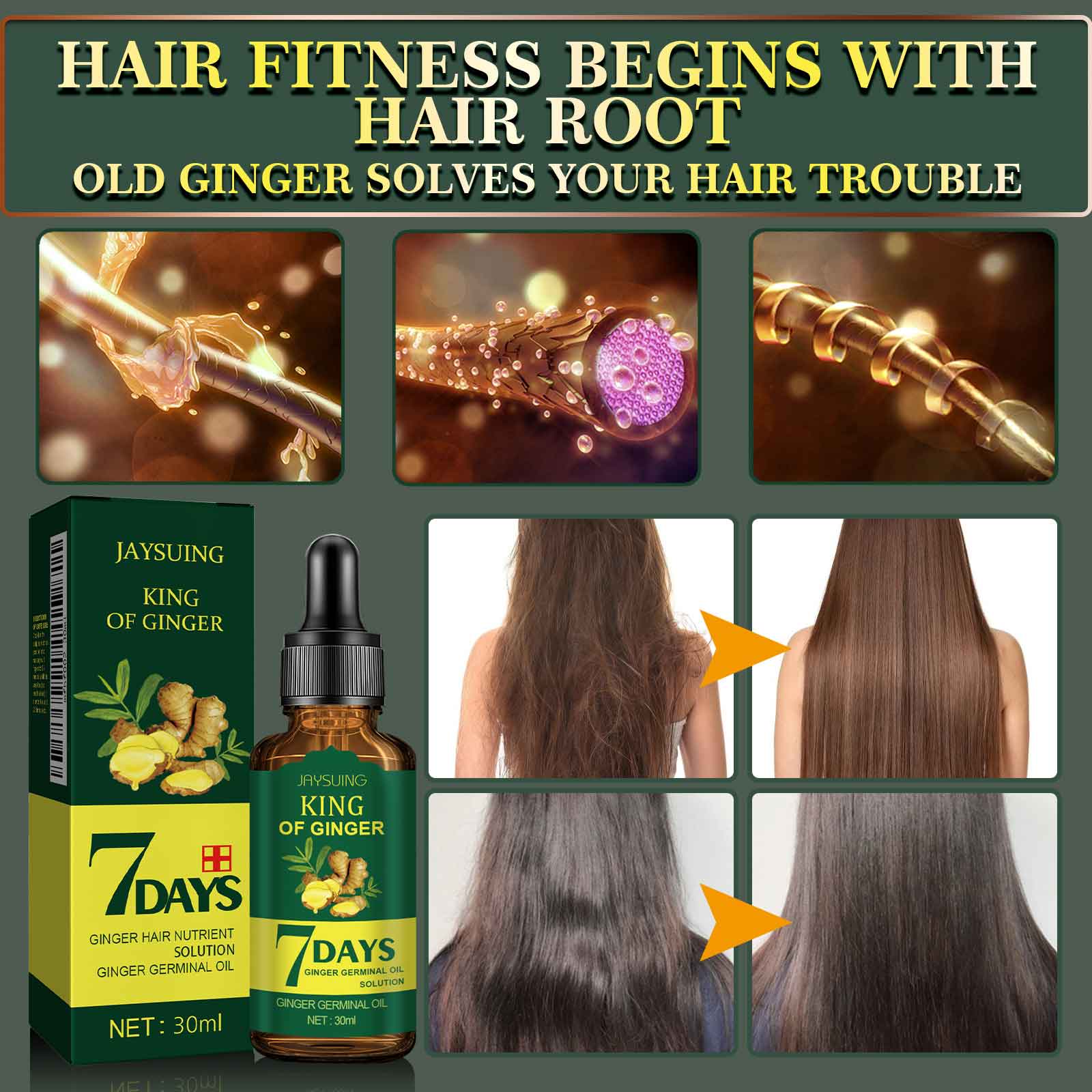 Jaysuing Ginger Hair Care Oil Refreshes and nourishes the scalp and hair follicles to strengthen the hair-CLEJOY
