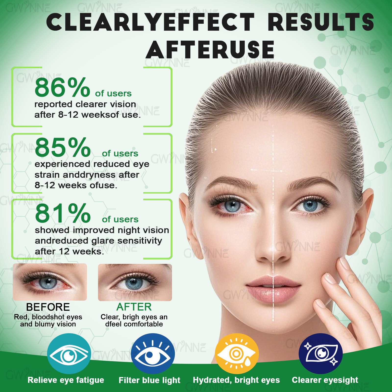 Gwynne Lutein Eye Vitamin Supplement 90 Cápsulas Suplemento Nutricional Para La Salud Macular Y El Ojo Seco Con Luteína, Zinc, Vitamina C/e Y Zeaxantina