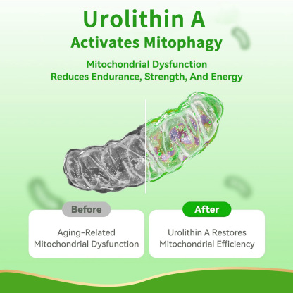 Gwynne Urolithin A 1000mg Complex Supplement 90 Cápsula,con Resveratrol,nr,coq10,pqq Y L-theanine Apoyo A La Energía Mitocondrial Y Celular