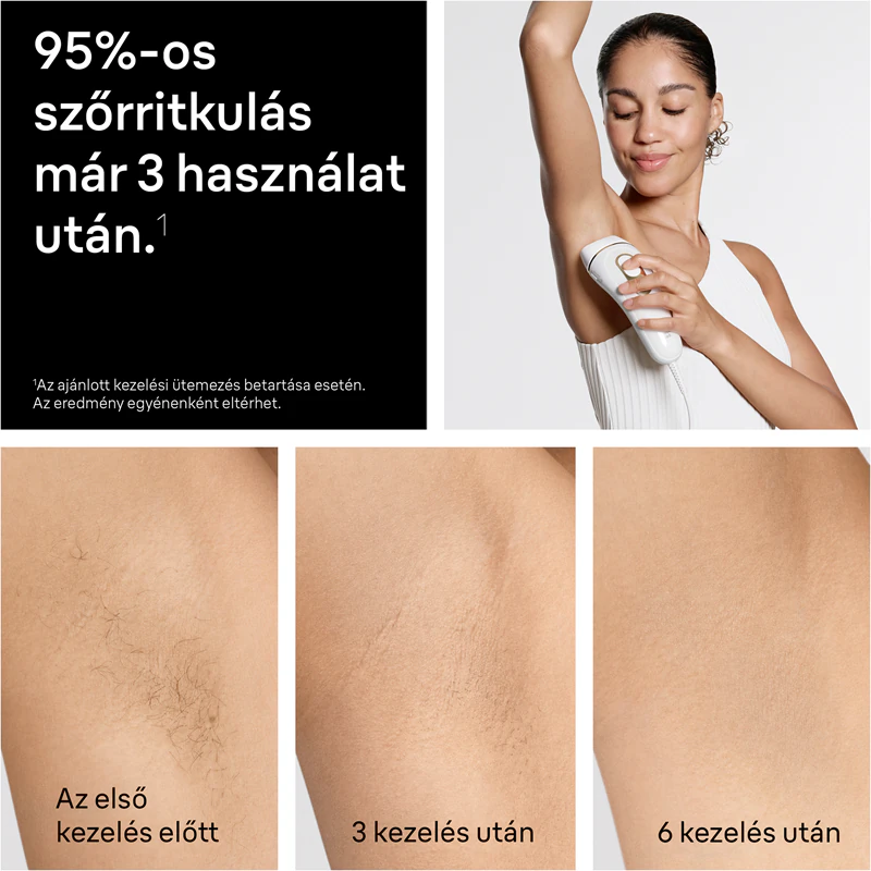 Braun IPL Silk·expert Pro 5 PL5412