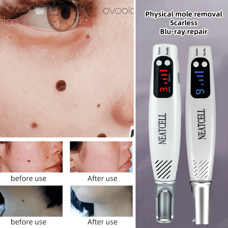 Mikro anyajegy eltávolító szemölcs eltávolító tetováló lézertoll