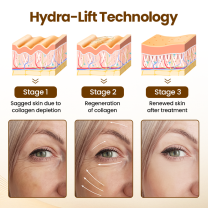 🔥Newyuo® Renewing 10s Wrinkle Serum