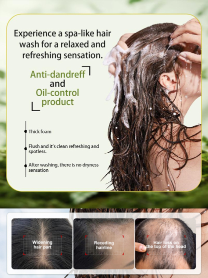 🌿 Rosemary extract + hydrolyzed keratin activate dormant hair follicles, stop hair loss, and promote thicker and longer new hair.