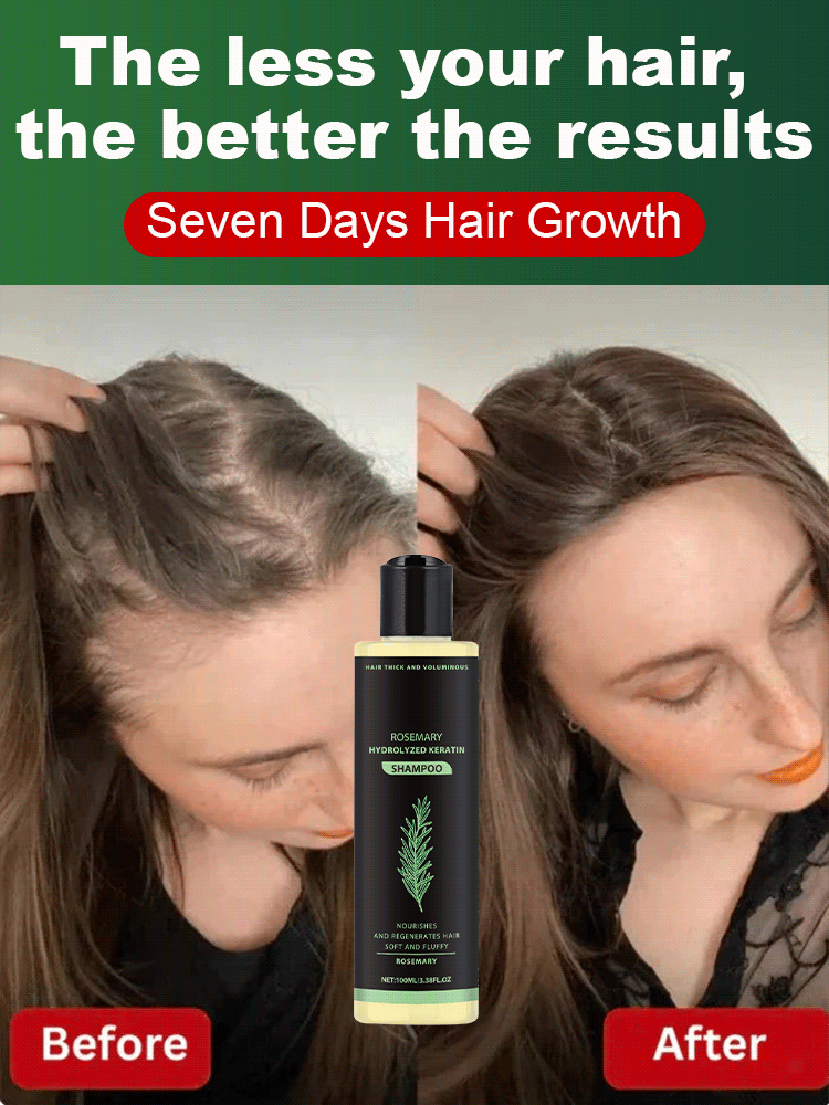 🌿 Rosemary extract + hydrolyzed keratin activate dormant hair follicles, stop hair loss, and promote thicker and longer new hair.
