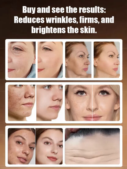 Arbutin and Niacinamide Anti-Wrinkle Cream📊99.7% brightening rate, 94.3% reduction in dark spot area, and 95% reduction in wrinkle visibility.