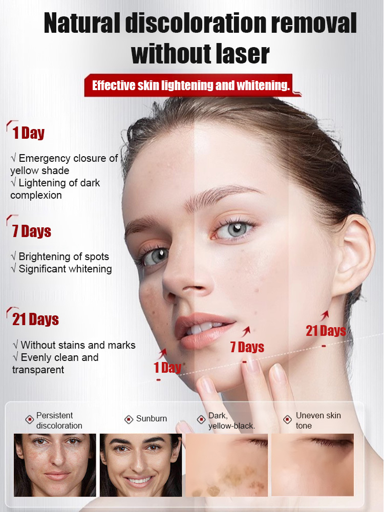 Arbutin and Niacinamide Anti-Wrinkle Cream📊99.7% brightening rate, 94.3% reduction in dark spot area, and 95% reduction in wrinkle visibility.