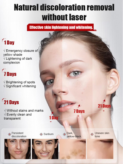 Arbutin and Niacinamide Anti-Wrinkle Cream📊99.7% brightening rate, 94.3% reduction in dark spot area, and 95% reduction in wrinkle visibility.