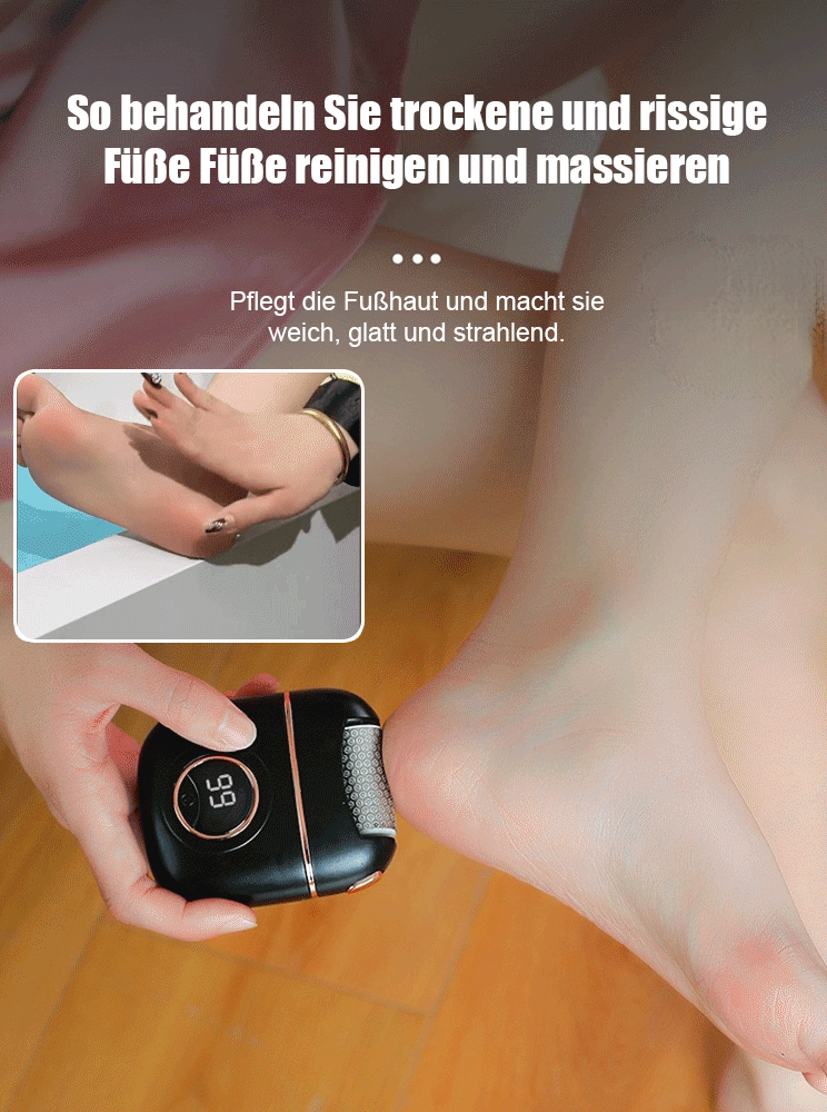 Entfernen Sie 10 Jahre alte Hornhaut in 10 Sekunden, ohne Ihre Haut zu schädigen!