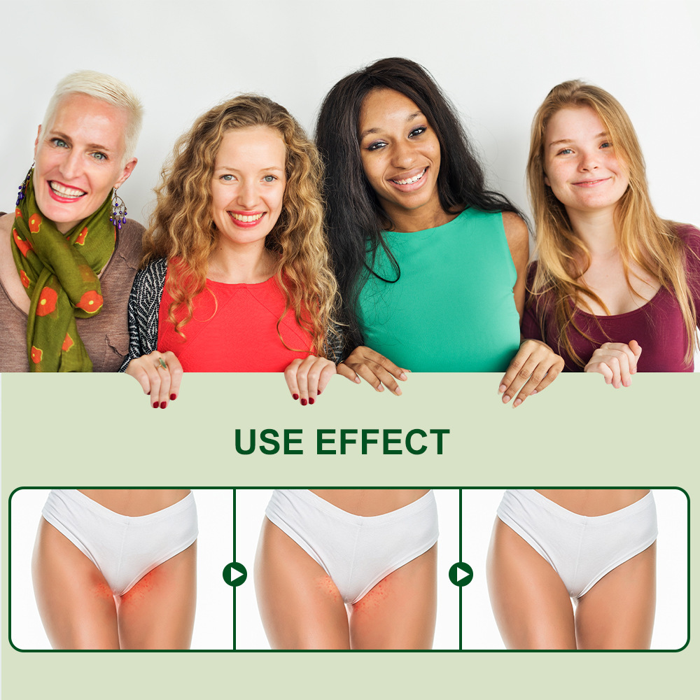 Tea Tree Oil Intimate Anti-Itch Cream Pussy Itch Cream -WeLovePlugs