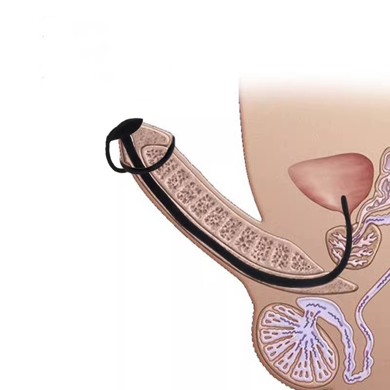 Fixable Silicone Urethral Sound -WeLovePlugs