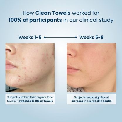  100% USDA Biobased Face Towel, Disposable Face Towelette, Eczema Association Accepted, Makeup Remover Dry Wipes, Ultra Soft