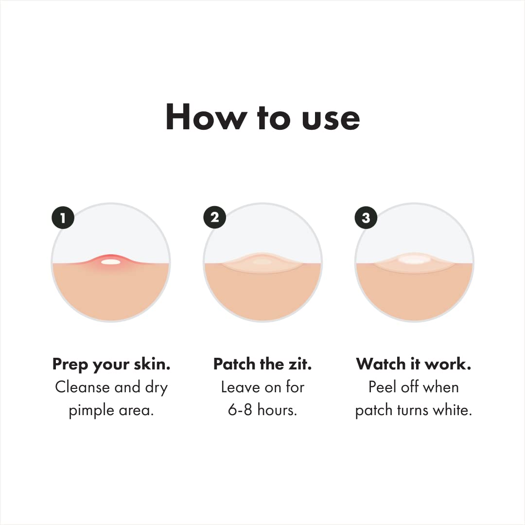 Original patch from Hero Cosmetics - Hydrocolloid Acne Pimple Patch for Covering Zits and Blemishes in Face and Skin, Vegan-friendly and Not Tested on Animals (36 Count)