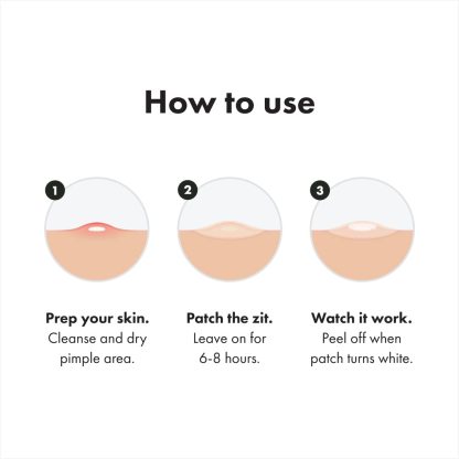 Original patch from Hero Cosmetics - Hydrocolloid Acne Pimple Patch for Covering Zits and Blemishes in Face and Skin, Vegan-friendly and Not Tested on Animals (36 Count)