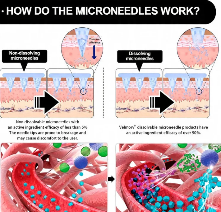 Fusegift® NanoMicroneedle Patch