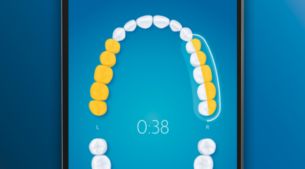 Bringt Sie zurück zu ausgelassenen Stellen für eine 100 %ige Abdeckung