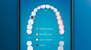 Pflegen Sie Problembereiche besser