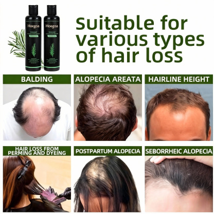 Tgideas Organic Rosemary Hair Growth Shampoo 