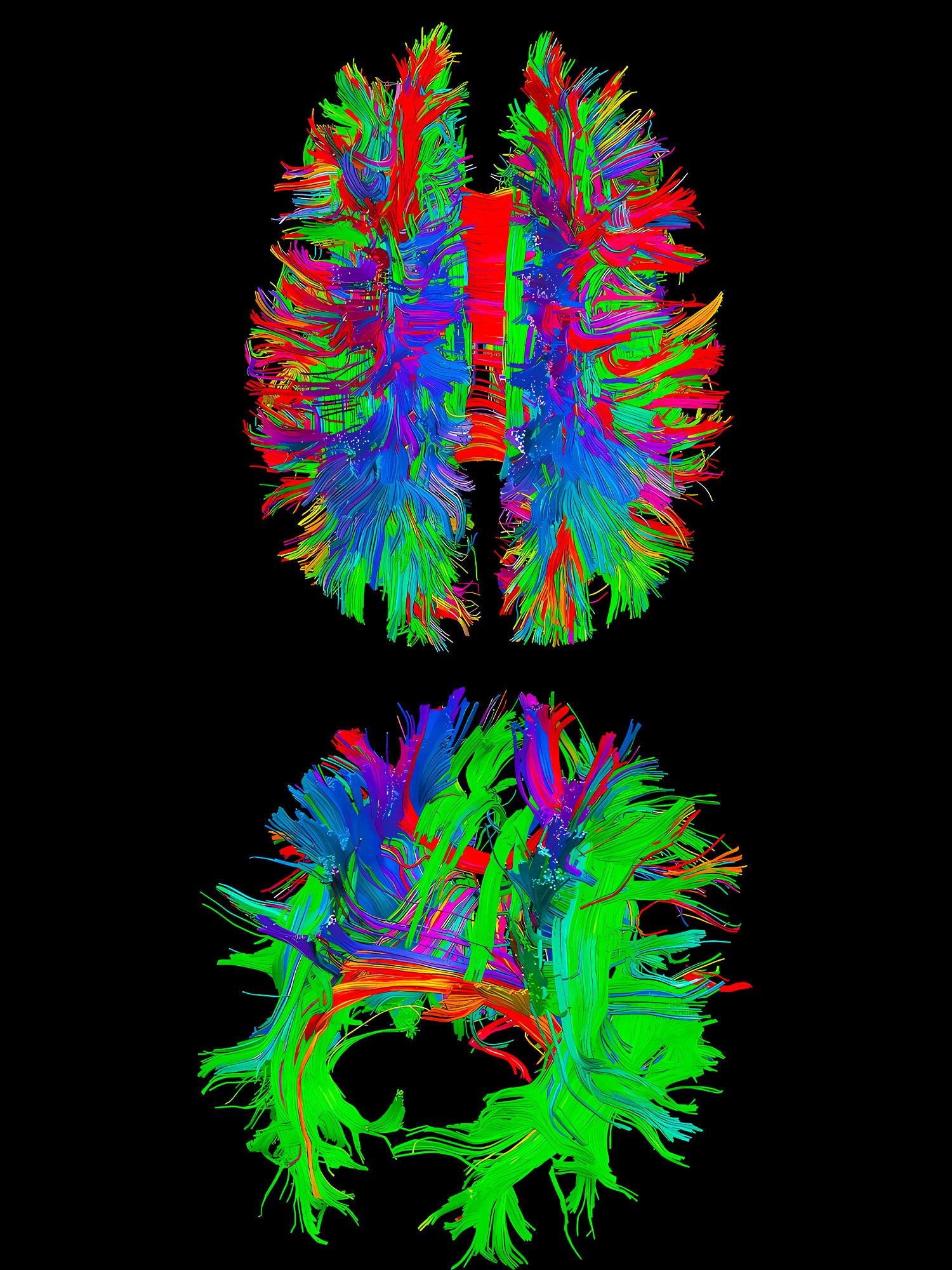 Thermal Imaging Brain Washed Tshirt