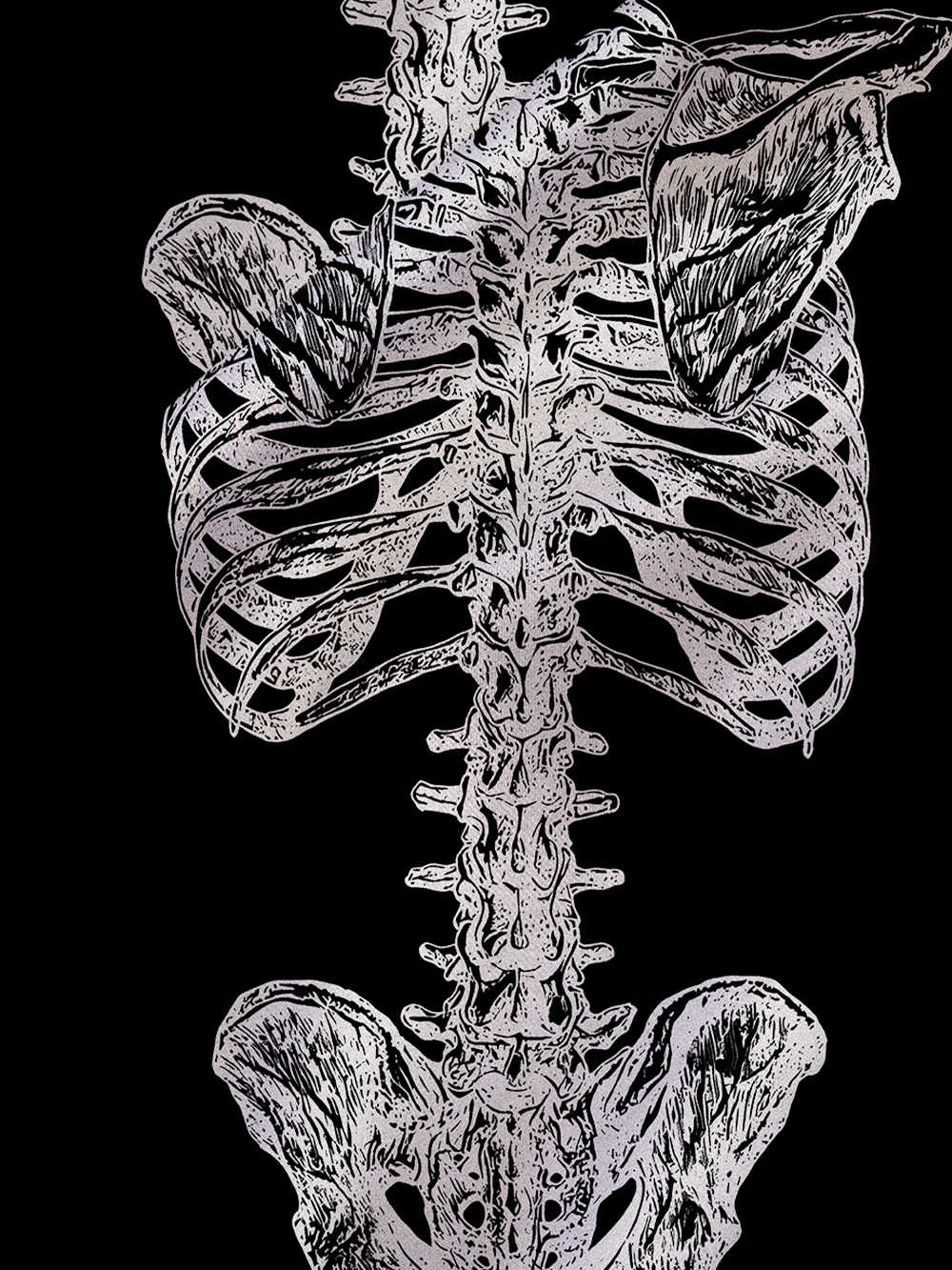 Bone Structure Satin Cross Back Mini Dress