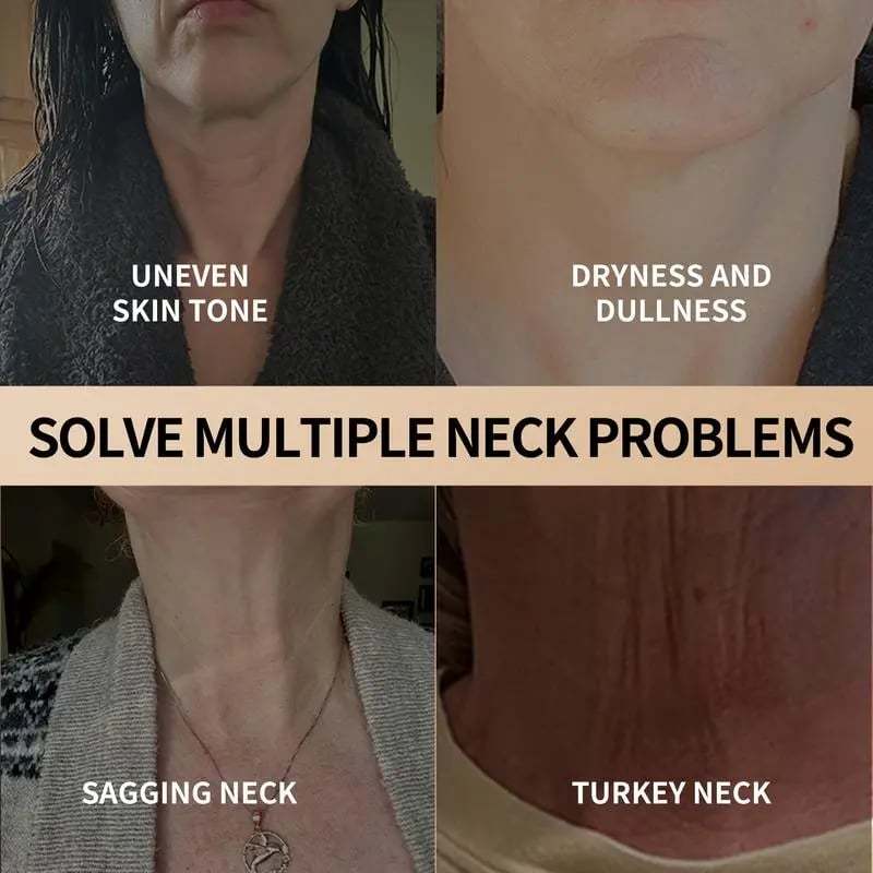 ✨Hot Sale 🔥Only $12.99 Today!!!🎉 Neck Cream