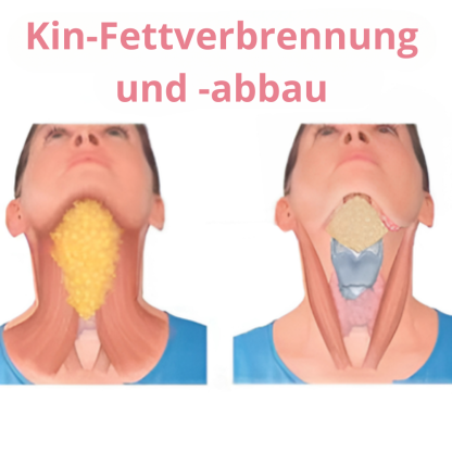 Facial Sculptor - Say Goodbye to Your Double Chin