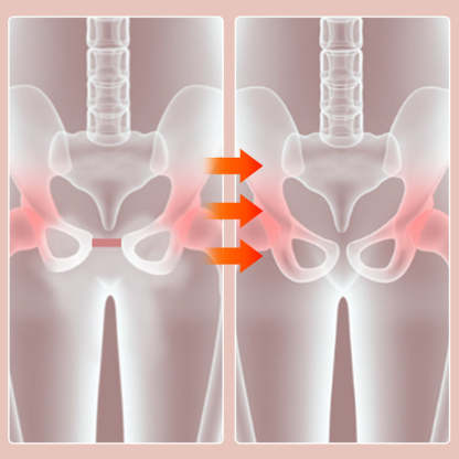 Pelvic Floor Trainer