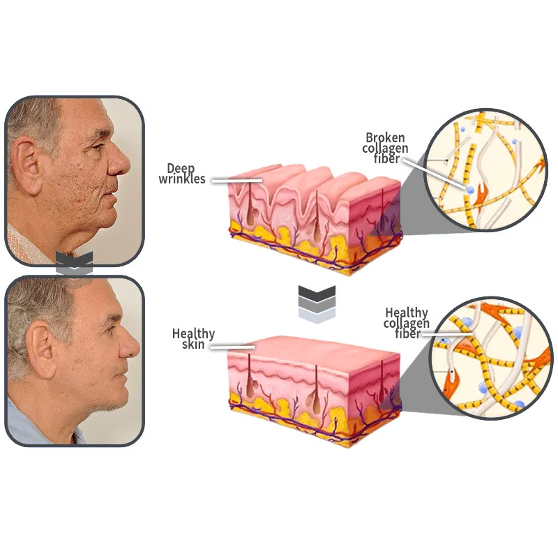 （🔥LAST DAY SALE-80% OFF)Micshinkec™ Ashoke Anti-Aging Men's Collagen Cream