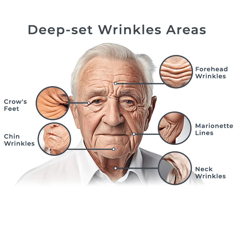 （🔥LAST DAY SALE-80% OFF)Micshinkec™ Ashoke Anti-Aging Men's Collagen Cream