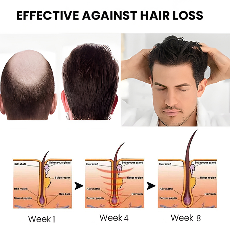 Healsy™ Hair Growth Spray