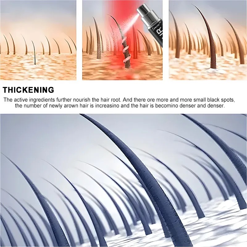 🔥Hot Sale🔥Lemcoy™ Hair Growth Spray