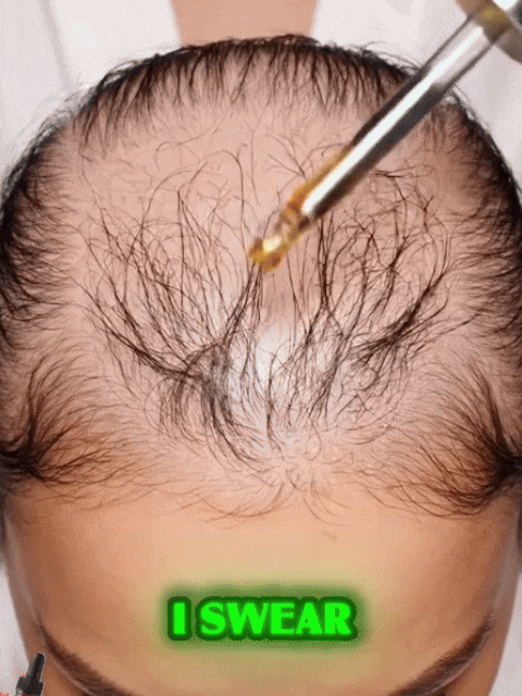 [No.1 Selling Hair Growth Product] Battana Rosemary Essential Oil