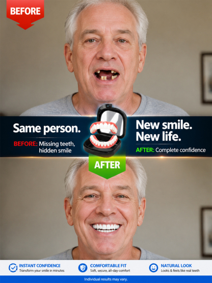 😁 [Limited Edition] Premium Dental Prosthesis – All-Inclusive, No Dentist Needed!