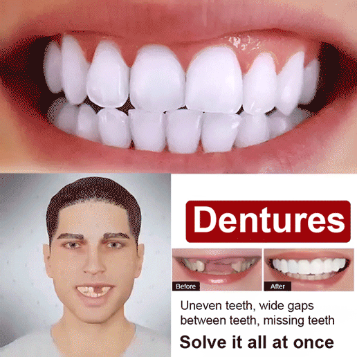 Perfect Smile Dentures🦷 – 1 Second to White, Neat Teeth & Boost Confidence 100x