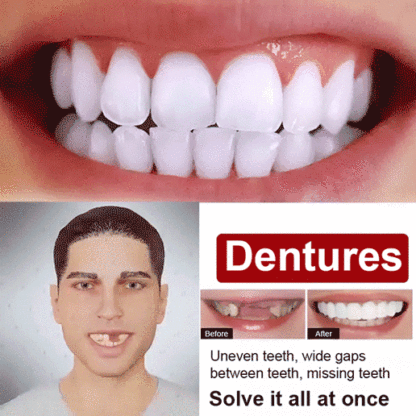 Perfect Smile Dentures🦷 – 1 Second to White, Neat Teeth & Boost Confidence 100x