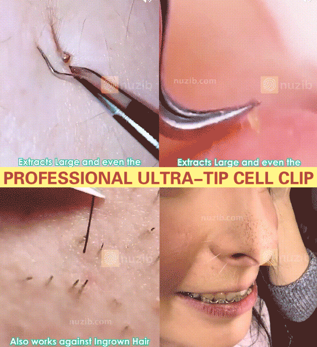 🖤✨ Bye-bye, blackheads and clogged pores! Precision cell tweezer to the rescue～ 