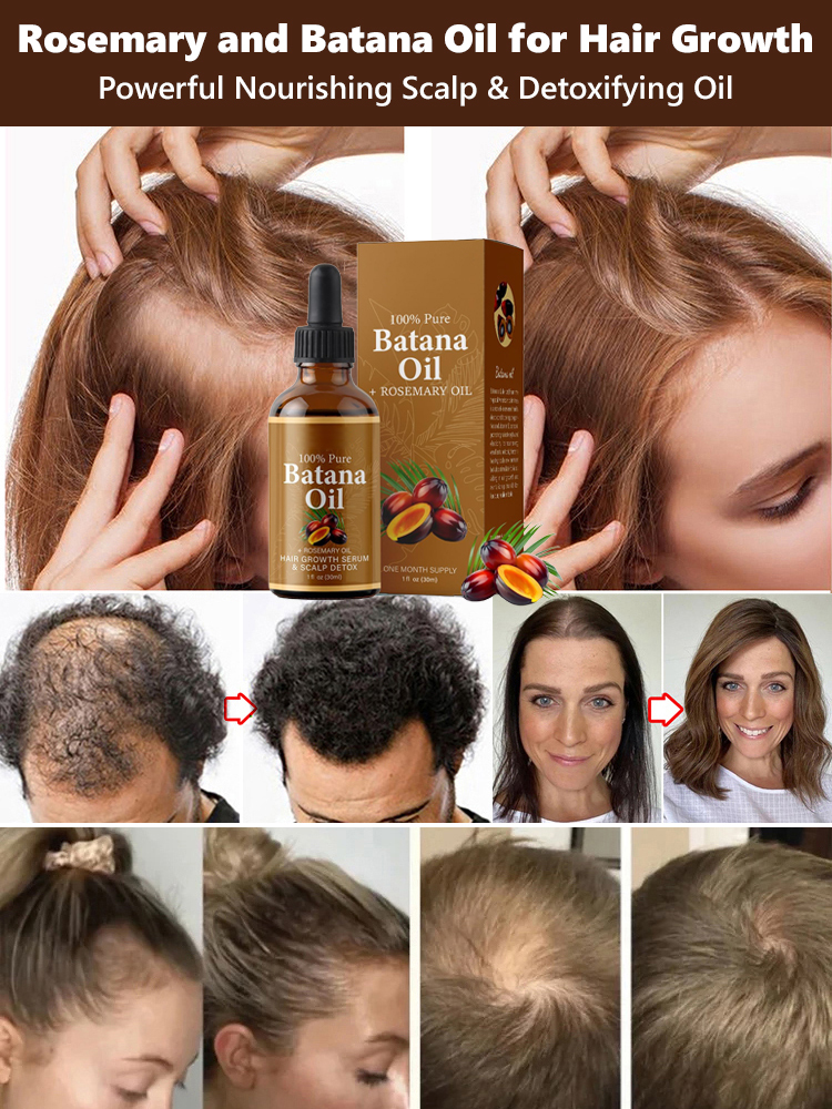 [No.1 Selling Hair Growth Product] Battana Rosemary Essential Oil