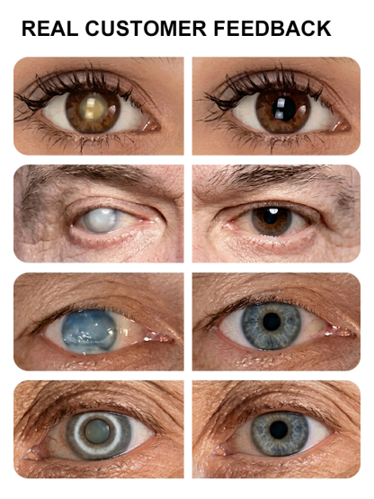 Instant correction for clear eyesight