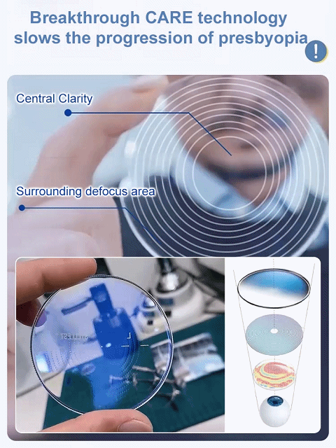  Clear Vision for Everyone — From Presbyopia to High Myopia (Up to -10.00D)