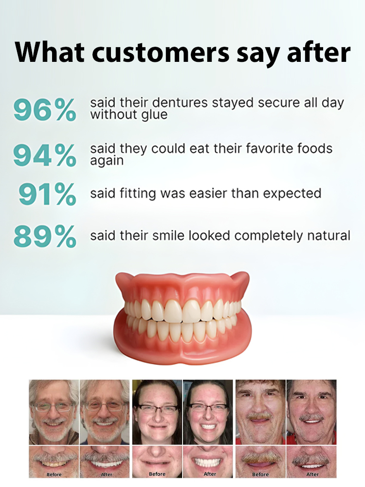 Natural Smile Denture Set – Over 200,000 units sold in just 3 days! ✨ 100% satisfaction guaranteed – Fixes yellowing teeth and missing teeth in seconds.