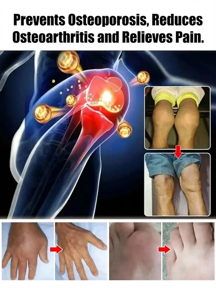 🍒 【100% Growth Guarantee】4J XXL Regina Sweet Cherry Tree Strong 2-Year-Old Saplings • Harvest in Year One • Perfect for Balconies & Gardens • Hardy to -20°C (-4°F)