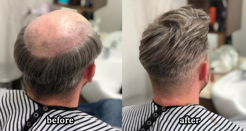 DIYSTAR™Root Activator Shampoo
